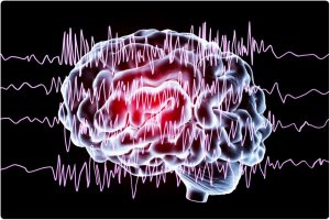 Epilepsy (Brain with waves illustration) | CBD OIL NZ